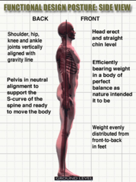 3 Posture Conditions That Can Cause Us Pain